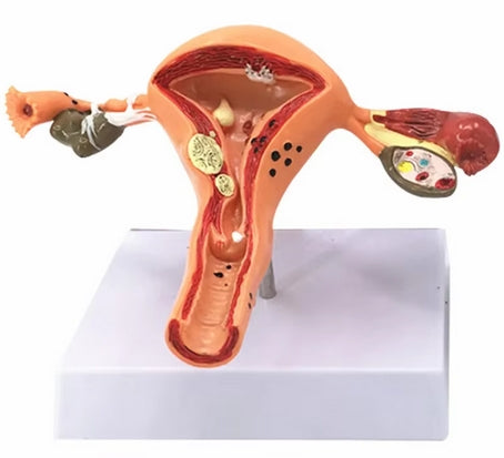 Modelo de útero grande feminino